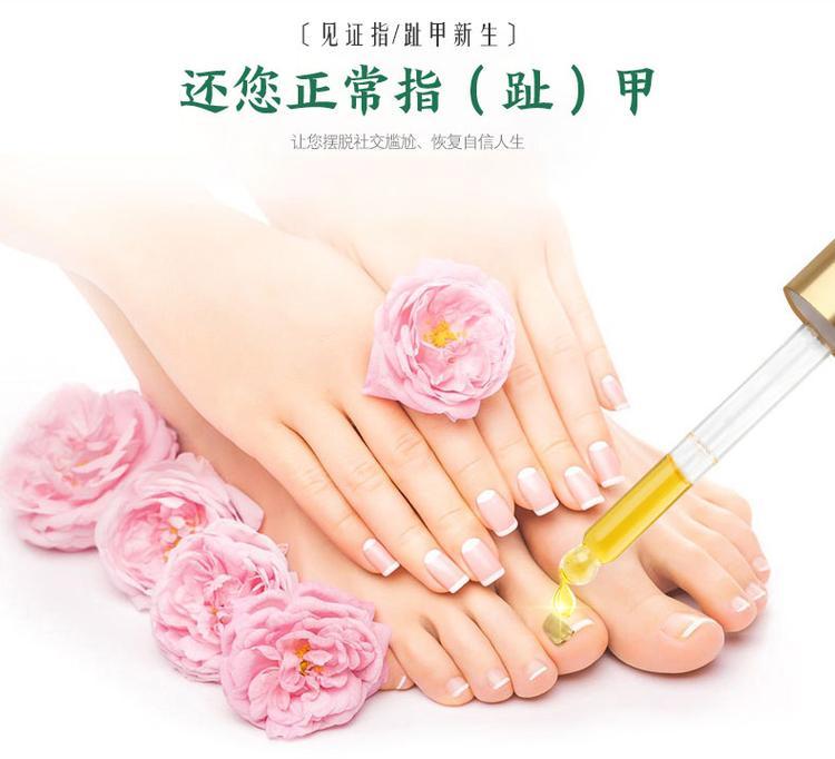 灰指甲抗菌液(圖6) 灰指甲液oem貼牌產(chǎn)品