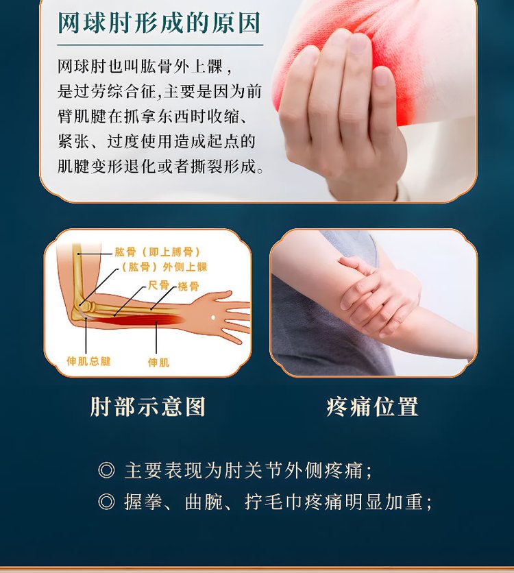 網(wǎng)球肘形成的原因 網(wǎng)球肘形成的原因